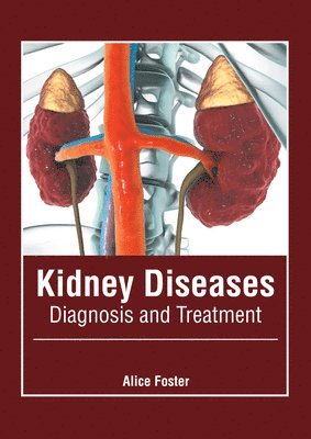 bokomslag Kidney Diseases: Diagnosis and Treatment