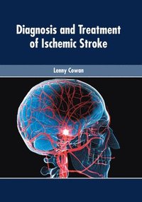 bokomslag Diagnosis and Treatment of Ischemic Stroke