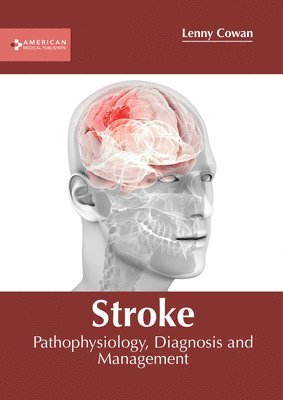 bokomslag Stroke: Pathophysiology, Diagnosis and Management