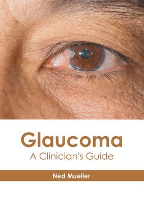 Glaucoma: A Clinician's Guide 1