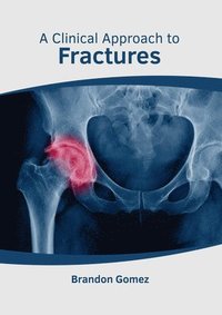 bokomslag A Clinical Approach to Fractures