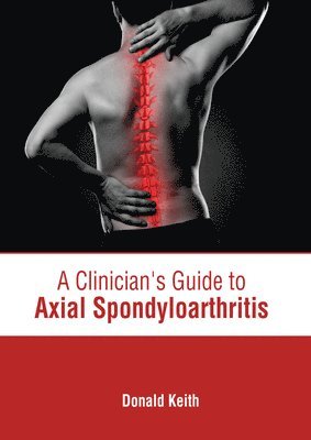 bokomslag A Clinician's Guide to Axial Spondyloarthritis