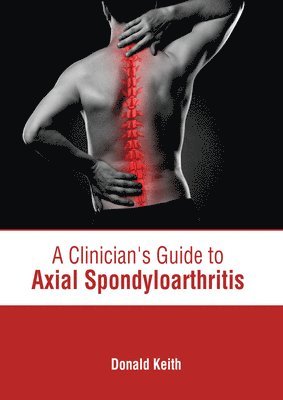 Donald Keith - Clinician's Guide to Axial Spondyloarthritis, Inbunden