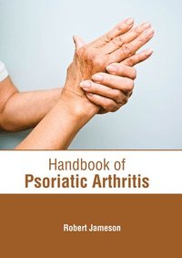 bokomslag Handbook of Psoriatic Arthritis