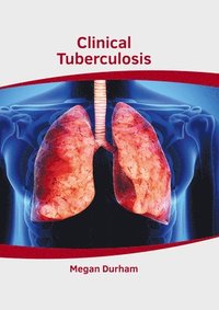 bokomslag Clinical Tuberculosis