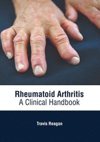 bokomslag Rheumatoid Arthritis: A Clinical Handbook