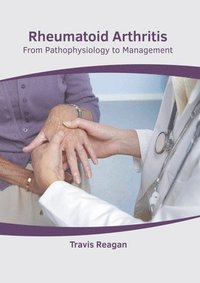 bokomslag Rheumatoid Arthritis: From Pathophysiology to Management