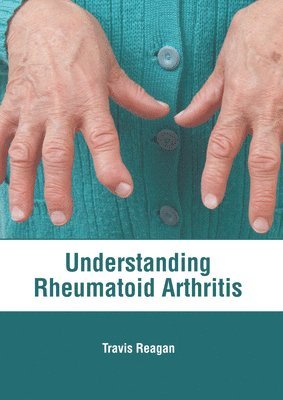 Understanding Rheumatoid Arthritis 1