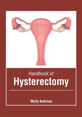 bokomslag Handbook of Hysterectomy