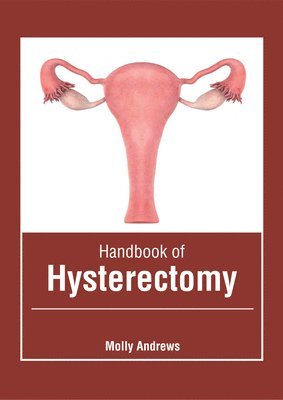 Molly Andrews - Handbook of Hysterectomy, Inbunden