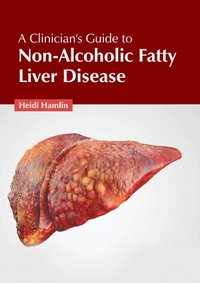 bokomslag A Clinician's Guide to Non-Alcoholic Fatty Liver Disease