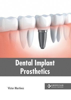 bokomslag Dental Implant Prosthetics