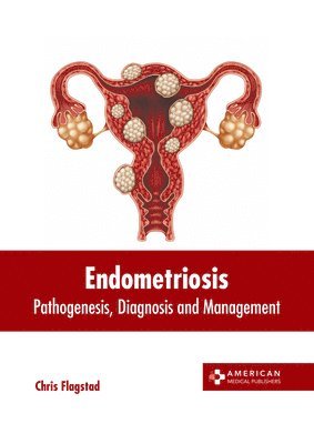 bokomslag Endometriosis: Pathogenesis, Diagnosis and Management