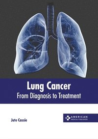 bokomslag Lung Cancer: From Diagnosis to Treatment