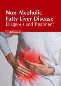 bokomslag Non-Alcoholic Fatty Liver Disease: Diagnosis and Treatment