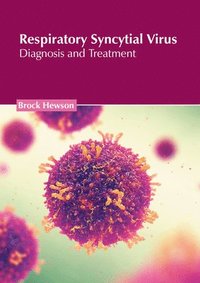 bokomslag Respiratory Syncytial Virus: Diagnosis and Treatment