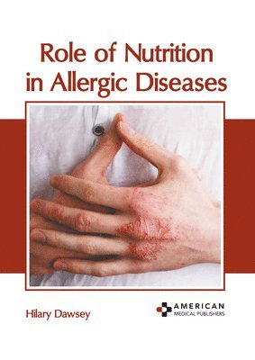 bokomslag Role of Nutrition in Allergic Diseases