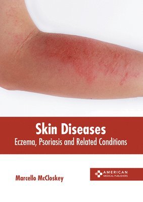 Skin Diseases: Eczema, Psoriasis and Related Conditions 1