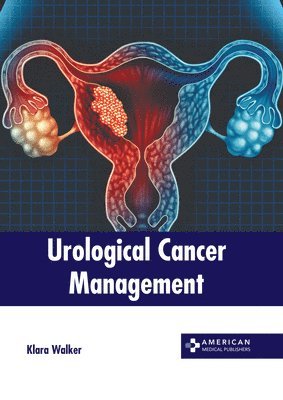 bokomslag Urological Cancer Management