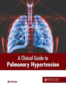 Jim Foster - Clinical Guide to Pulmonary Hypertension, Inbunden