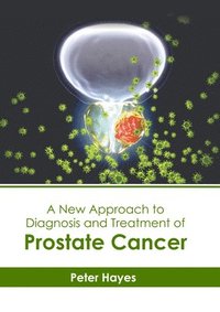 bokomslag A New Approach to Diagnosis and Treatment of Prostate Cancer