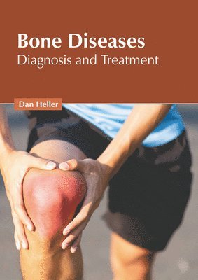 bokomslag Bone Diseases: Diagnosis and Treatment