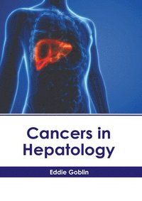 bokomslag Cancers in Hepatology