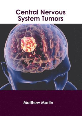Matthew Martin - Central Nervous System Tumors, Inbunden
