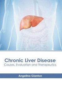 bokomslag Chronic Liver Disease: Causes, Evaluation and Therapeutics