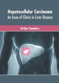 bokomslag Hepatocellular Carcinoma: An Issue of Clinics in Liver Disease