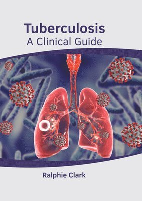 bokomslag Tuberculosis: A Clinical Guide