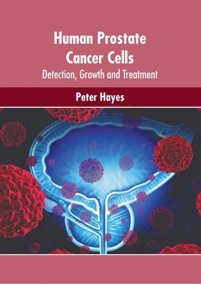 Peter Hayes - Human Prostate Cancer Cells: Detection, Growth and Treatment, Inbunden