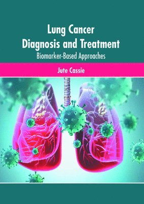 bokomslag Lung Cancer Diagnosis and Treatment: Biomarker-Based Approaches