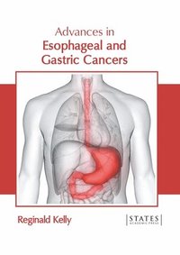 bokomslag Advances in Esophageal and Gastric Cancers