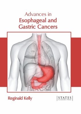 Reginald Kelly - Advances in Esophageal and Gastric Cancers, Inbunden