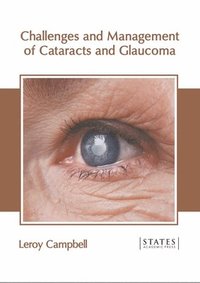 bokomslag Challenges and Management of Cataracts and Glaucoma
