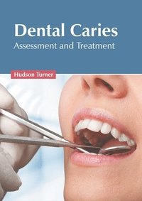 bokomslag Dental Caries: Assessment and Treatment