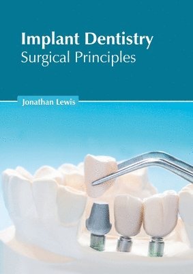 Jonathan Lewis - Implant Dentistry: Surgical Principles, Inbunden