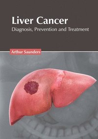 bokomslag Liver Cancer: Diagnosis, Prevention and Treatment