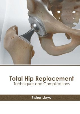 Fisher Lloyd - Total Hip Replacement: Techniques and Complications, Inbunden