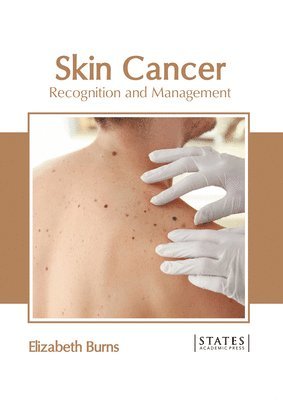 bokomslag Skin Cancer: Recognition and Management