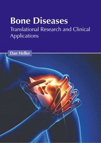 bokomslag Bone Diseases: Translational Research and Clinical Applications