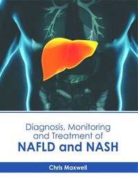 bokomslag Diagnosis, Monitoring and Treatment of Nafld and Nash