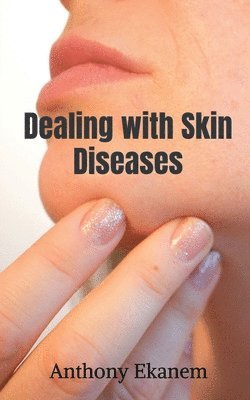 Anthony Ekanem - Dealing with Skin Diseases, Häftad
