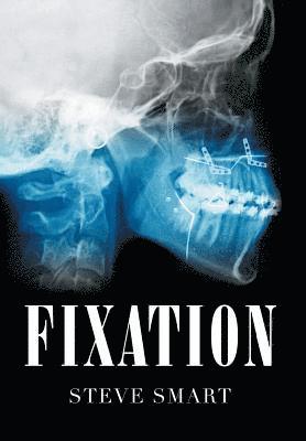 Fixation 1