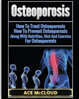 Osteoporosis 1