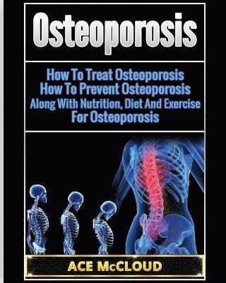 Osteoporosis 1