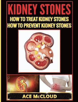 Kidney Stones 1