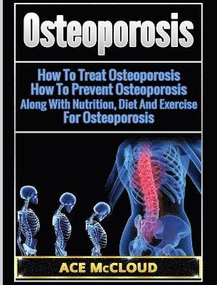 Osteoporosis 1