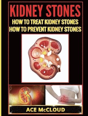 bokomslag Kidney Stones